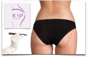 Conferenza Stampa presentazione “B-UP: Nuova Tecnica Sollevamento Glutei, Mercoledì 5 Marzo 2014